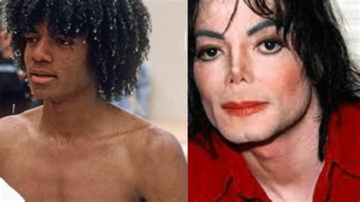 Did Michael Jackson Have a Disease? Uncovering the Truth Behind His Health