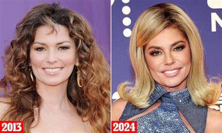 Has Shania Twain Had Plastic Surgery? Unveiling the Truth Behind Her Timeless Beauty