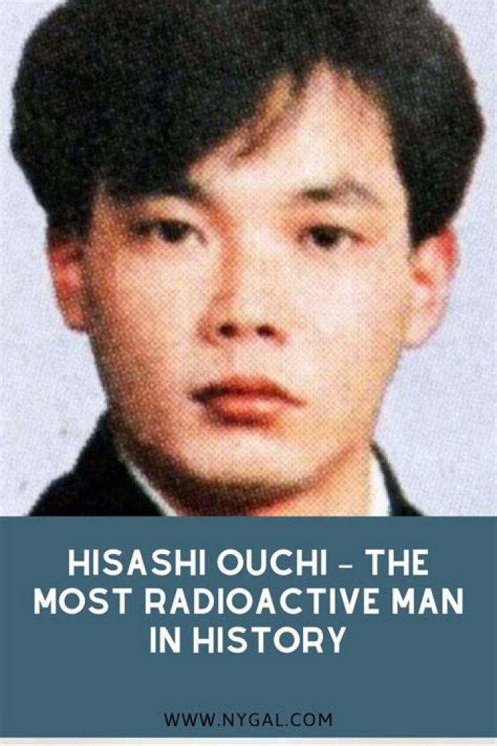 Hisashi Ouchi: The Real Picture Behind a Tragic Story
