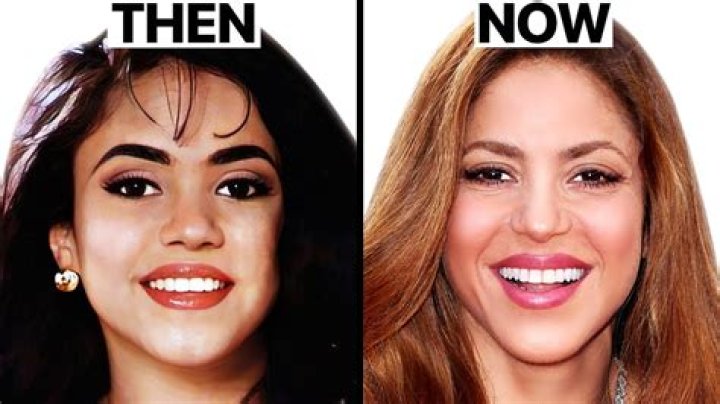 Kim Bella Before and After Plastic Surgery: A Comprehensive Analysis