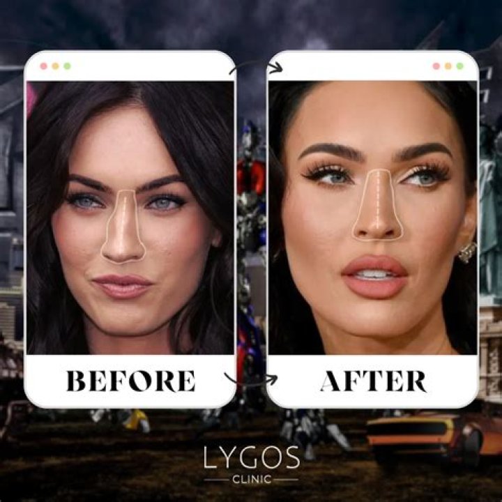 Megan Fox Nose Before and After: A Comprehensive Analysis