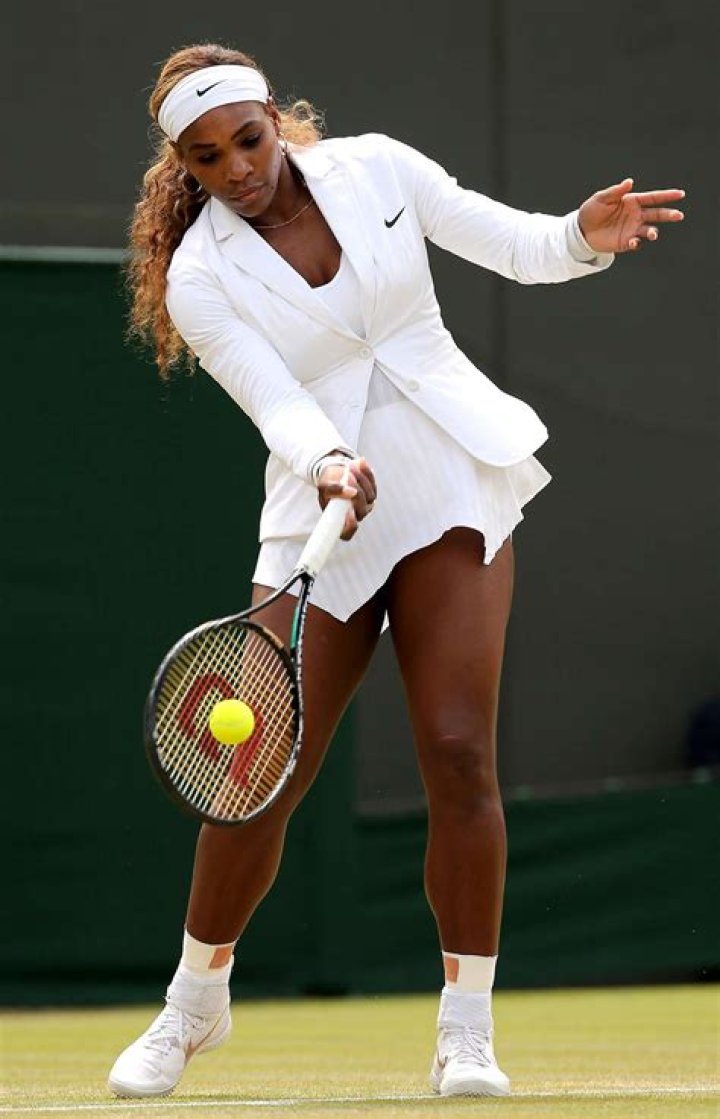 Serena Williams: The Truth Behind Plastic Surgery Rumors