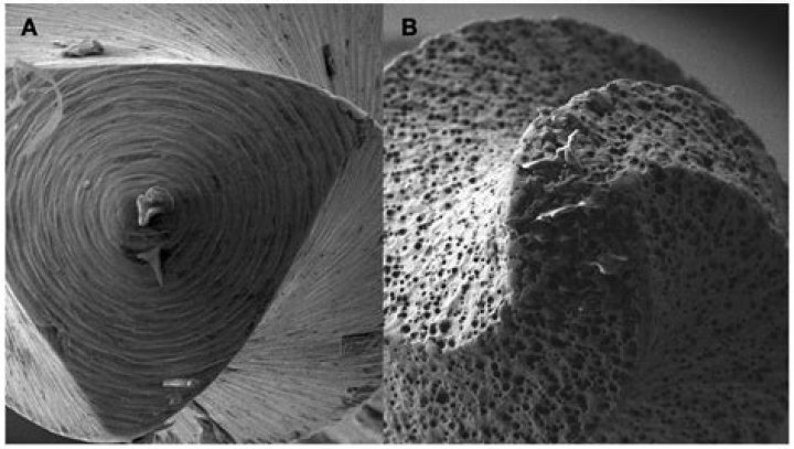 Tarrare Anatomy: Unraveling the Mysteries of a Rare Condition
