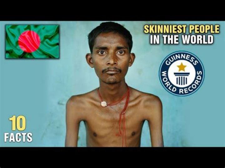 The Skinniest Person in the World: A Deep Dive into Extreme Slimness