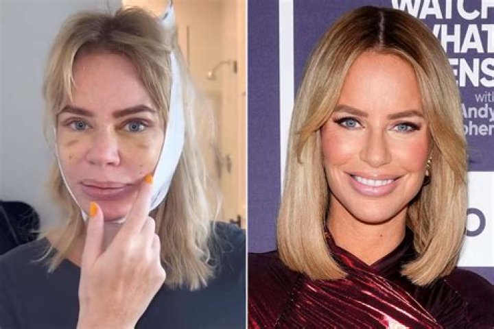 Transformations of Caroline Stanbury: A Glimpse Before Her Facelift