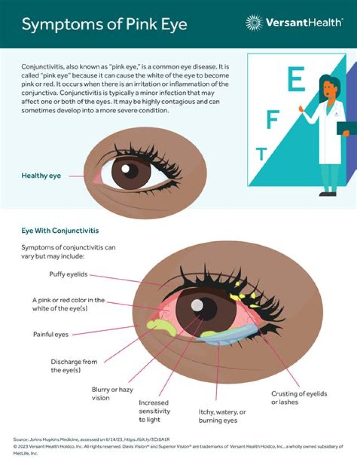 Understanding the Pink Eye Meme: Origins, Impact, and Cultural Significance