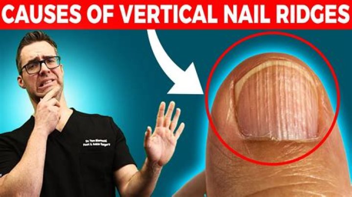 Understanding Vertical Ridges: Causes, Treatments, and Prevention
