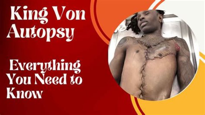 Unraveling the Mystery: King Von Autopsy Picture and Its Impact