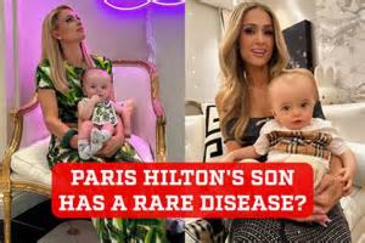 Unveiling the Journey: Paris Hilton's Son and Hydrocephalus